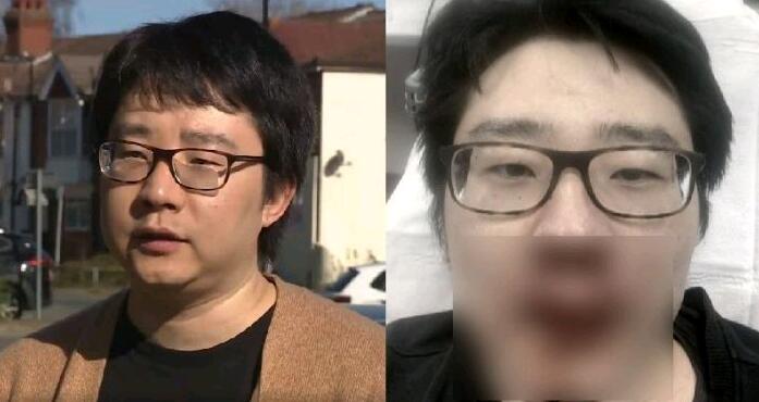 王鹏遇袭后受伤画面